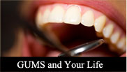 Gums and Your Life