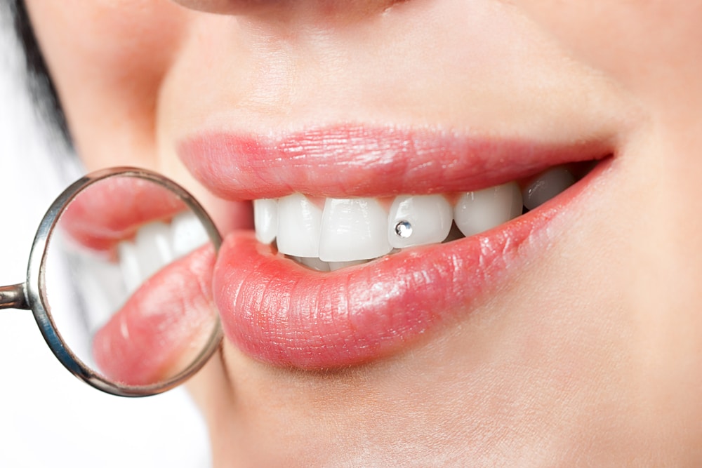 tooth gems bad for your teeth Syracuse UT