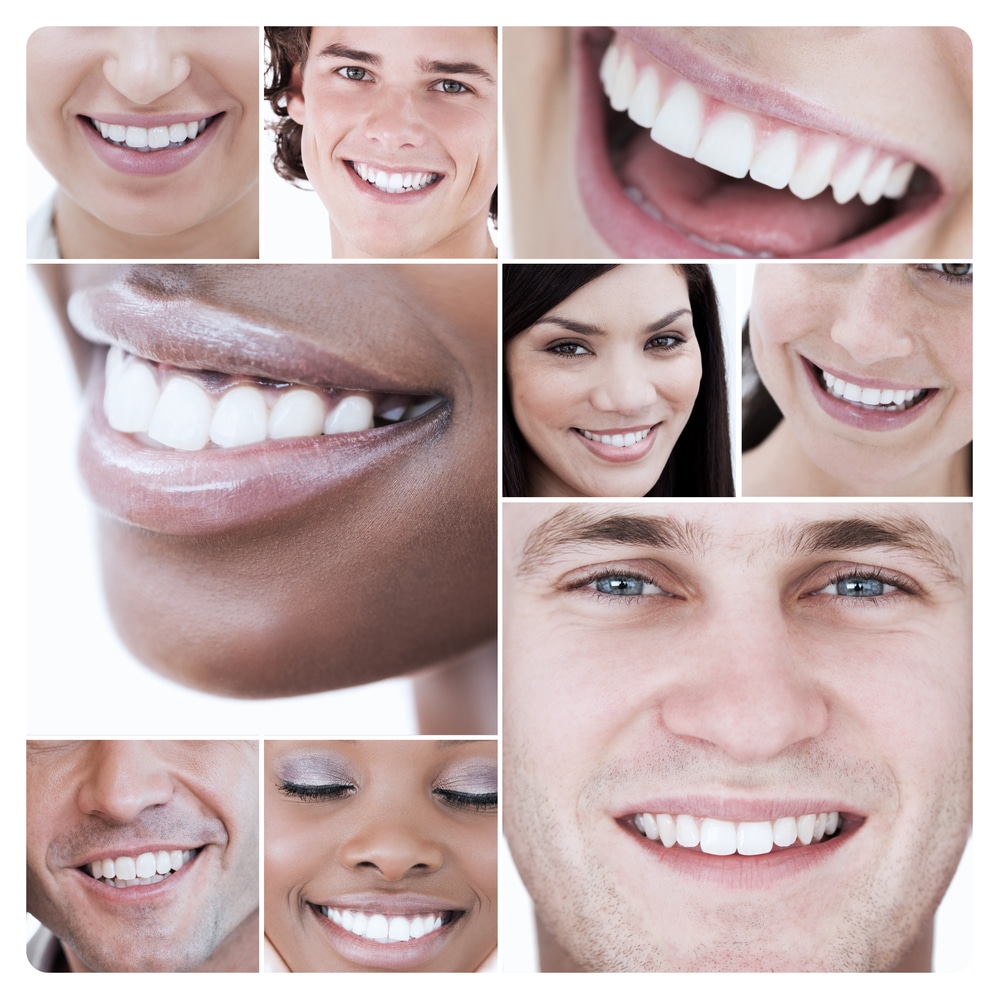 white teeth desirable