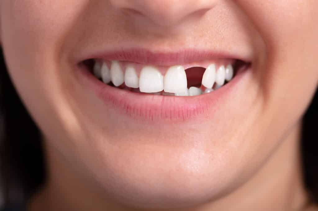 6 Dental Issues Orthodontics Can Fix