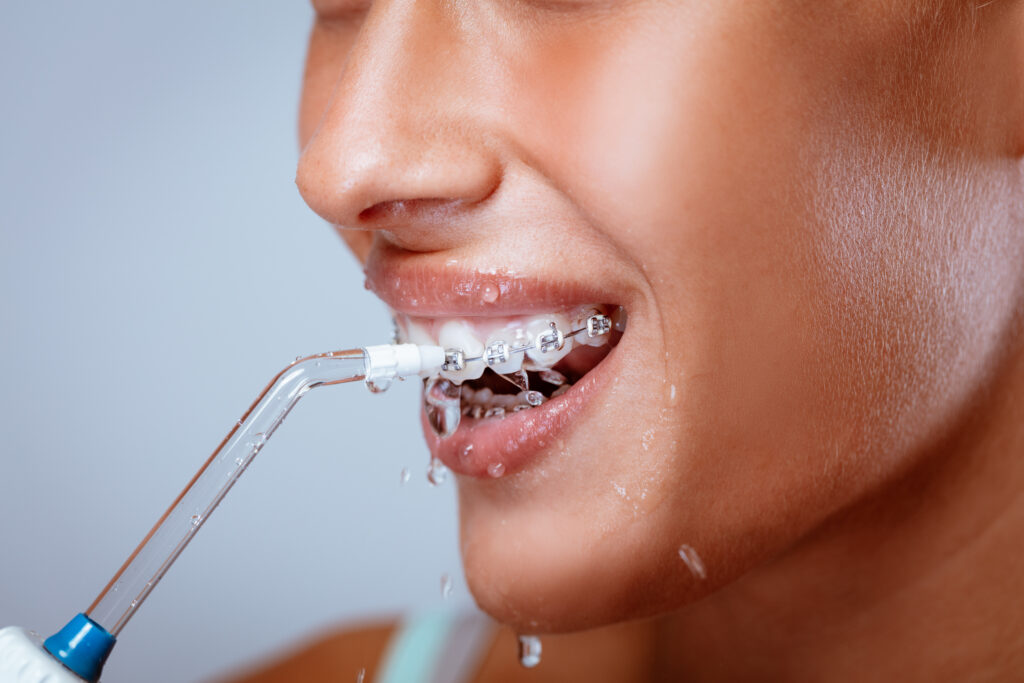 5 Benefits Of Water Flossers 5 Benefits of Water Flossers