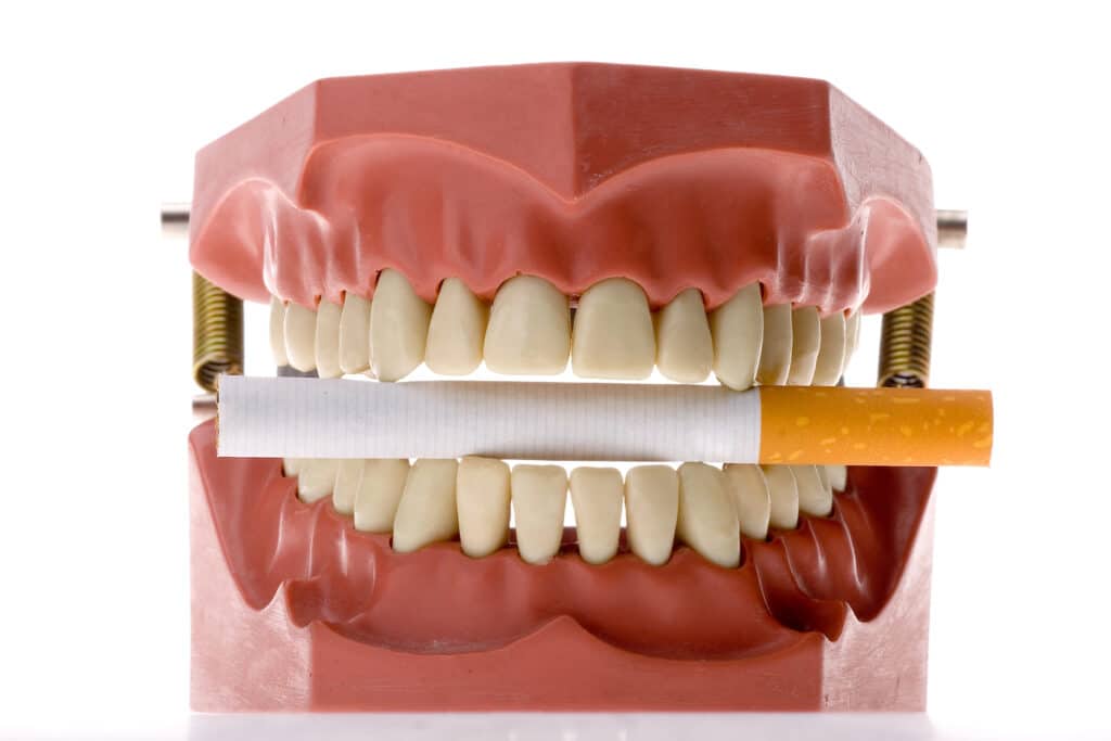 The Importance Of Oral Cancer Screening oral cancer screen Syracuse UT