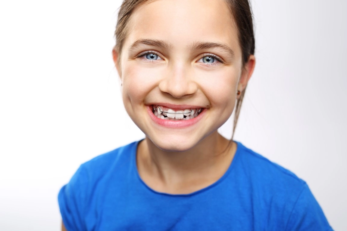 malocclusion